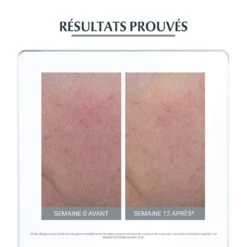 Anti Rougeurs Soin De Jour Teinte 50ml Peau Hypersensible Eucerin 11 Anti Rougeurs Soin De Jour Teinte 50ml Peau Hypersensible Eucerin -Care Série Magasin 112081