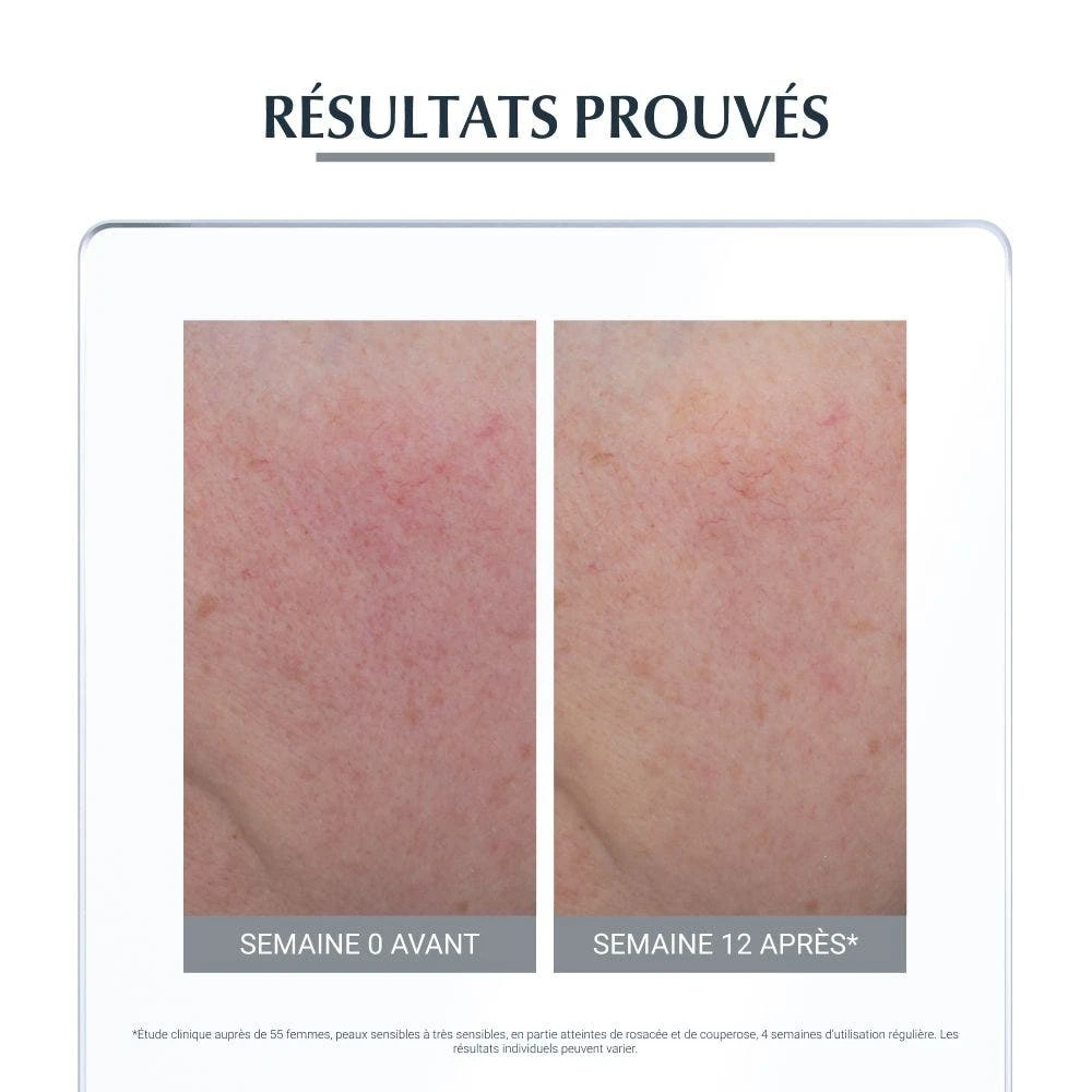 Anti Rougeurs Soin De Jour Teinte 50ml Peau Hypersensible Eucerin 6 Anti Rougeurs Soin De Jour Teinte 50ml Peau Hypersensible Eucerin – Image 4